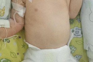 重庆一男子感染新冠后出现罕见症状，专家紧急提醒